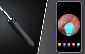 Xiaomi'nin kameralı akıllı kulak temizleyicisi ile tanışın!